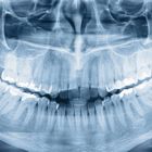 Radiología dental Teruel